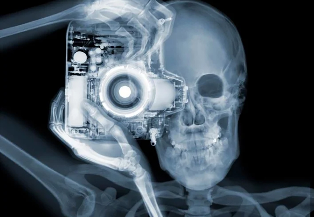 product-generalradiography