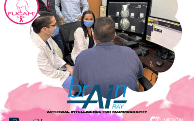 FUCAM MEXICO: A NEW ERA BEGINS IN EARLY BREAST CANCER DETECTION WITH AI